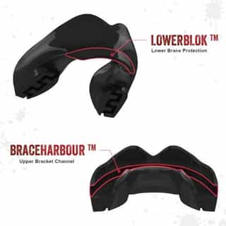 ЗА ЗЪБИ SAFEJAWZ SENIOR ЗА БРЕКЕТИ 1