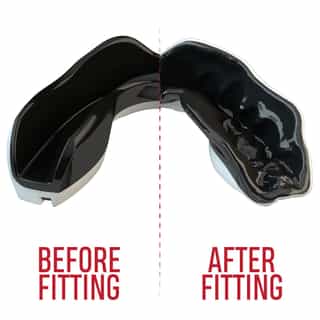-Зъби-SAFEJAWZ-EXTRO-SERIES-SELF-FIT-MO-MOUTHGUARD-1.jpg за Зъби SAFEJAWZ EXTRO SERIES SELF FIT MO MOUTHGUARD 1