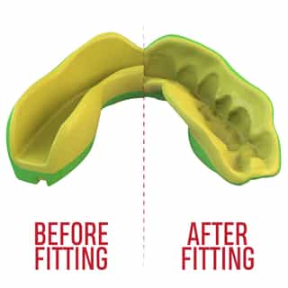 -Зъби-SAFEJAWZ-EXTRO-SERIES-SELF-FIT-OGRE-MOUTHGUARD-1.jpg за Зъби SAFEJAWZ EXTRO SERIES SELF FIT OGRE MOUTHGUARD 1