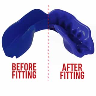 -Зъби-SAFEJAWZ-INTRO-SERIES-BLUE-3.jpg за Зъби SAFEJAWZ INTRO SERIES BLUE 3