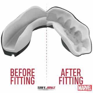 detski protektor za zybi safejawz marvel venom 3 детски протектор за зъби safejawz marvel venom 2