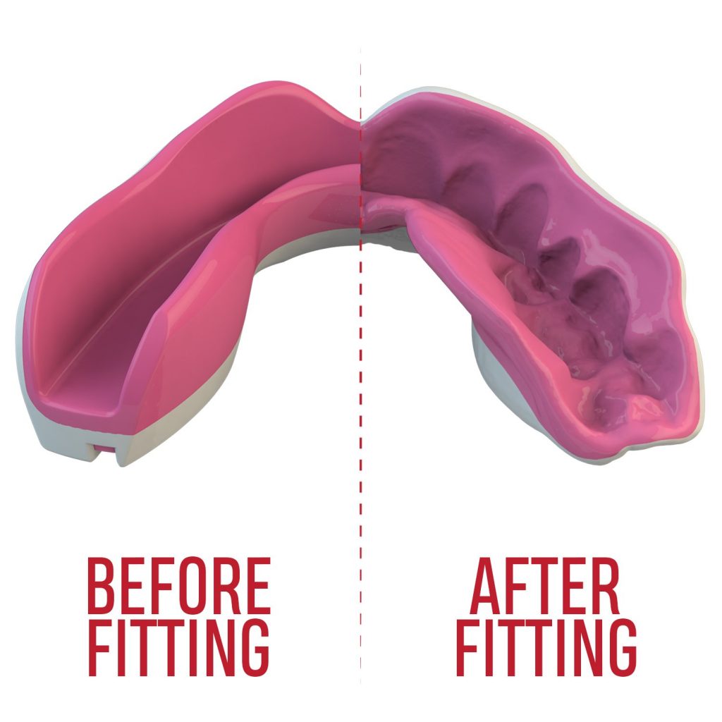 за Зъби SAFEJAWZ EXTRO SERIES SELF FIT PINK FANGZ MOUTHGUARD 6